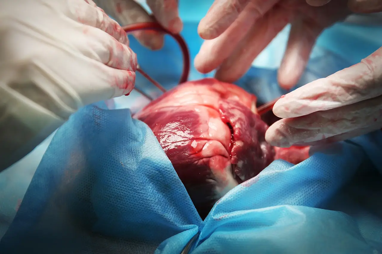 Como funciona a logística do transplante de órgão?